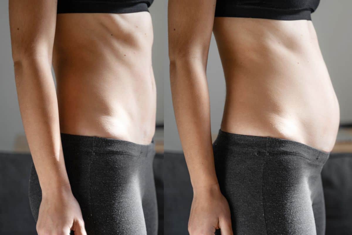 How long does diastasis recti take to improve Bridgend?