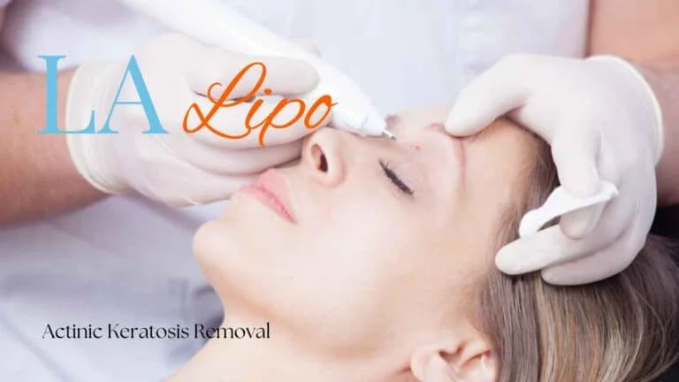 Woman receiving Actinic Keratosis Removal Treatment Bridgend