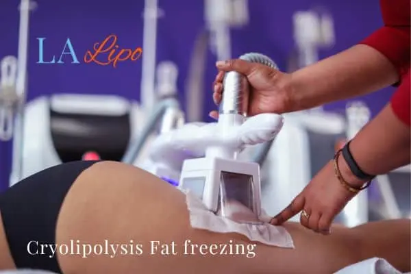 women getting fat freezing Bridgend