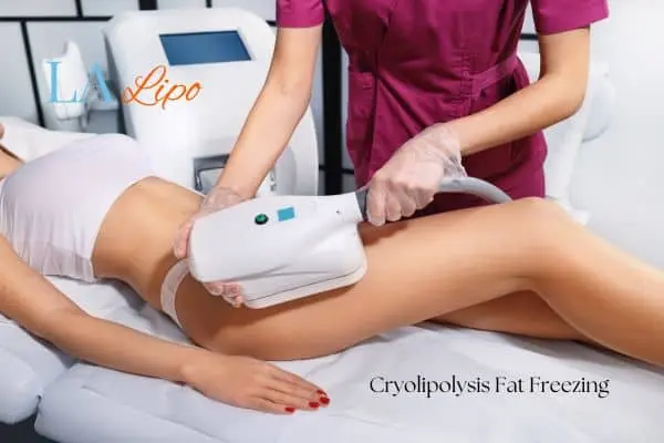 Woman receiving coolsculpting Bridgend treatment on her thighs