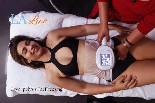 woman getting cryolipolysis Bridgend