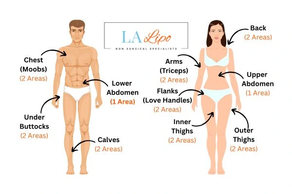 LA LIPO Cryolipolysis Areas Bridgend
