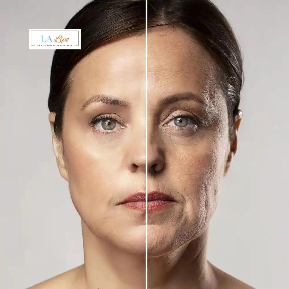How Can You Tell If Non-Surgical Skin Tightening Is Right for You Bridgend?
