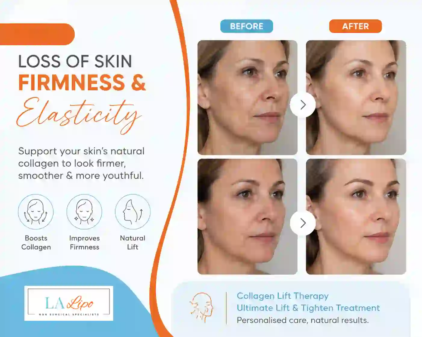 Sign #7: Loss of Skin Firmness and Elasticity Bridgend