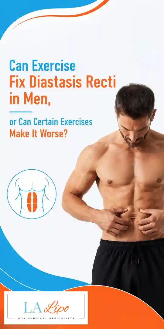 Can Exercise Fix Diastasis Recti in Men, or Can Certain Exercises Make It Worse Bridgend?